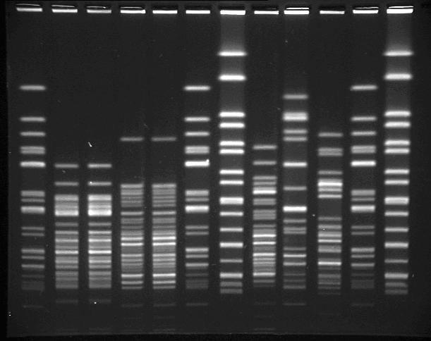 Image Source: Gel Electrophoresis