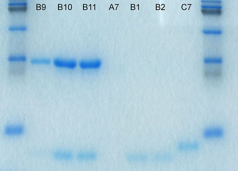 Image Source: Polyacrylamide Gel Electrophoresis